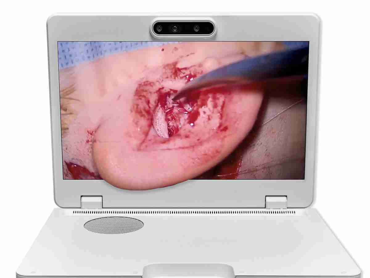 达擎之＂Heads-up 3D显微手术显示系统＂，，整合4K裸眼3D显示及眼球追踪系统，，具备快速追踪人眼移动位置功能，，，减轻医师长时间维持固定姿势的负担，，，，让医师能有更宽广清晰的3D立体视野及更舒适的姿势来执行手术。。。